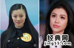 刘翔老婆葛天整容